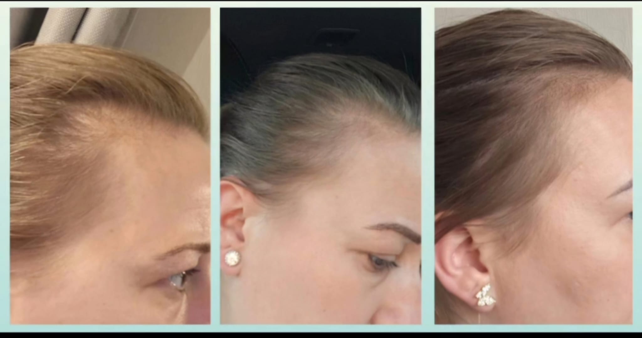Hair Nourishment Oil