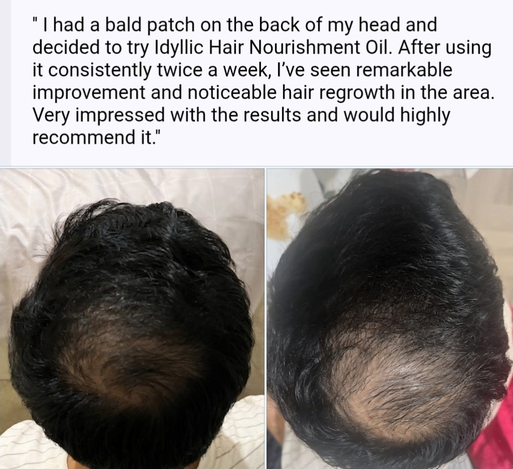 Idyllic hair nourishment oil comparison image